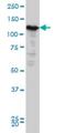 Immunoglobulin superfamily DCC subclass member 4 antibody, H00057722-M03, Novus Biologicals, Western Blot image 