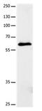 Dihydropyrimidinase Like 5 antibody, orb107488, Biorbyt, Western Blot image 