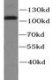 Catenin alpha-1 antibody, FNab00327, FineTest, Western Blot image 
