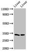 Regucalcin antibody, CSB-PA623001LA01HU, Cusabio, Western Blot image 
