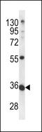 Methyltransferase Like 11B antibody, LS-C164155, Lifespan Biosciences, Western Blot image 