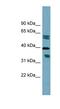 Dehydrogenase/Reductase 7B antibody, NBP1-62572, Novus Biologicals, Western Blot image 