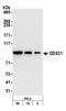 DExD-Box Helicase 21 antibody, A300-629A, Bethyl Labs, Western Blot image 