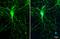 Synaptic Ras GTPase Activating Protein 1 antibody, GTX131673, GeneTex, Immunofluorescence image 