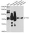 Tumor Protein P63 antibody, LS-C748036, Lifespan Biosciences, Western Blot image 