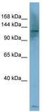 Phospholipase C Beta 1 antibody, TA333384, Origene, Western Blot image 