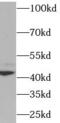 DNA repair protein XRCC4 antibody, FNab09554, FineTest, Western Blot image 
