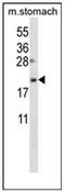 Oligosaccharyltransferase complex subunit OSTC antibody, AP53125PU-N, Origene, Western Blot image 