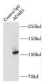 Double-stranded RNA-specific adenosine deaminase antibody, FNab00150, FineTest, Immunoprecipitation image 