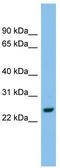 Adenylate kinase 2, mitochondrial antibody, TA338993, Origene, Western Blot image 