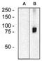 Rho Guanine Nucleotide Exchange Factor 4 antibody, AM26710RP-N, Origene, Western Blot image 