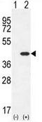C-Type Lectin Domain Containing 11A antibody, AP50956PU-N, Origene, Western Blot image 