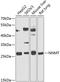 Nicotinamide N-Methyltransferase antibody, A02676, Boster Biological Technology, Western Blot image 