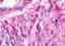 Adhesion G Protein-Coupled Receptor B3 antibody, MBS247078, MyBioSource, Immunohistochemistry frozen image 