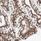 Coiled-Coil Domain Containing 18 antibody, PA5-55752, Invitrogen Antibodies, Immunohistochemistry frozen image 