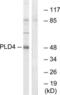 Phospholipase D Family Member 4 antibody, LS-B9097, Lifespan Biosciences, Western Blot image 