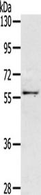 Olfactomedin 3 antibody, TA350251, Origene, Western Blot image 