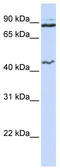 Minichromosome Maintenance 9 Homologous Recombination Repair Factor antibody, TA341692, Origene, Western Blot image 