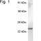 Secretory carrier-associated membrane protein 5 antibody, PA1-737, Invitrogen Antibodies, Western Blot image 