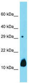 Dual Specificity Phosphatase 15 antibody, TA332171, Origene, Western Blot image 