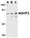 Protein Tyrosine Phosphatase Non-Receptor Type 11 antibody, AP05610PU-N, Origene, Western Blot image 