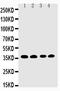 Eukaryotic translation initiation factor 2 subunit 1 antibody, PA2029, Boster Biological Technology, Western Blot image 