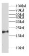 Complexin 2 antibody, FNab01922, FineTest, Western Blot image 