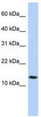 Interferon Alpha Inducible Protein 27 Like 2 antibody, TA339596, Origene, Western Blot image 