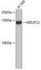 NADH:Ubiquinone Oxidoreductase Subunit C2 antibody, 19-031, ProSci, Western Blot image 