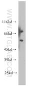 V(D)J recombination-activating protein 2 antibody, 11825-1-AP, Proteintech Group, Western Blot image 