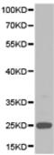 Adenylate kinase isoenzyme 4, mitochondrial antibody, TA323489, Origene, Western Blot image 