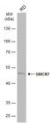 Mitochondrial Elongation Factor 2 antibody, GTX120484, GeneTex, Western Blot image 