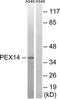 Peroxisomal Biogenesis Factor 14 antibody, TA314330, Origene, Western Blot image 