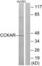 Cholecystokinin A Receptor antibody, abx015273, Abbexa, Western Blot image 