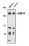 Death Associated Protein Kinase 1 antibody, PA5-17055, Invitrogen Antibodies, Western Blot image 