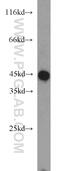 Sterol O-Acyltransferase 2 antibody, 14755-1-AP, Proteintech Group, Western Blot image 