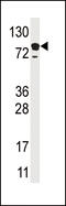 Epidermal growth factor receptor substrate 15 antibody, 61-119, ProSci, Western Blot image 