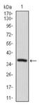 Sequestosome 1 antibody, TA336949, Origene, Western Blot image 
