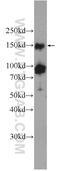 PHD finger protein 2 antibody, 24624-1-AP, Proteintech Group, Western Blot image 