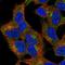 Probable palmitoyltransferase ZDHHC21 antibody, HPA065254, Atlas Antibodies, Immunocytochemistry image 