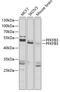 6-phosphofructo-2-kinase/fructose-2,6-biphosphatase 3 antibody, 22-575, ProSci, Western Blot image 