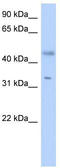 Short Chain Dehydrogenase/Reductase Family 16C Member 5 antibody, TA340321, Origene, Western Blot image 