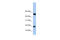 LOC285033 antibody, 26-881, ProSci, Enzyme Linked Immunosorbent Assay image 