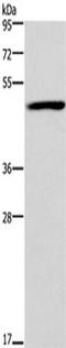 Forkhead Box D1 antibody, TA322738, Origene, Western Blot image 