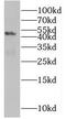Solute Carrier Family 25 Member 24 antibody, FNab07937, FineTest, Western Blot image 