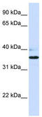 Beta-1,3-Galactosyltransferase 1 antibody, TA338450, Origene, Western Blot image 