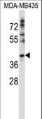 DnaJ Heat Shock Protein Family (Hsp40) Member C28 antibody, LS-C167478, Lifespan Biosciences, Western Blot image 