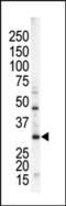 Serine/Threonine Kinase 16 antibody, MBS9201091, MyBioSource, Western Blot image 