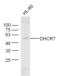 7-Dehydrocholesterol Reductase antibody, GTX51622, GeneTex, Western Blot image 