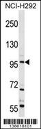 Transient Receptor Potential Cation Channel Subfamily C Member 4 antibody, 58-703, ProSci, Western Blot image 
